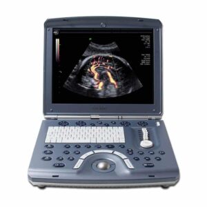 GE Voluson i Portable Ultrasound Machine
